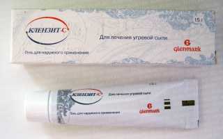 Адапален или бензоила пероксид?