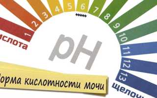 Повышенная кислотность мочи