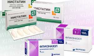 Нистатин или Флуконазол — что лучше?