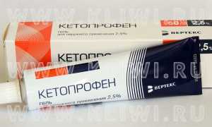 Ибупрофен гель или Кетопрофен