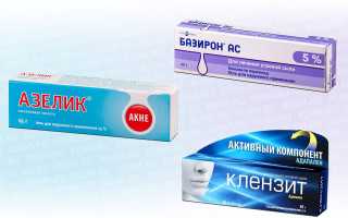 Азелаиновая кислота против адапалена и бензоил пероксида