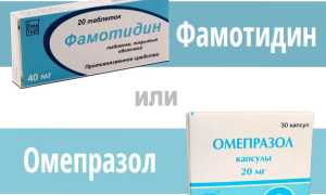 Фамотидин или Омепразол — что лучше?