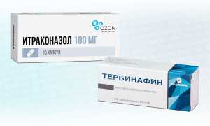 Итраконазол или Тербинафин